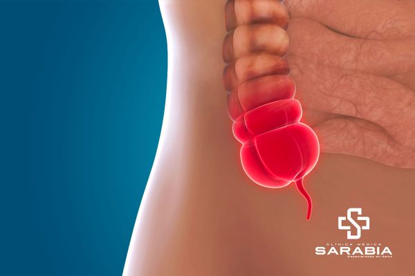 Apendicitis Aguda clinica sarabia tehuacan puebla