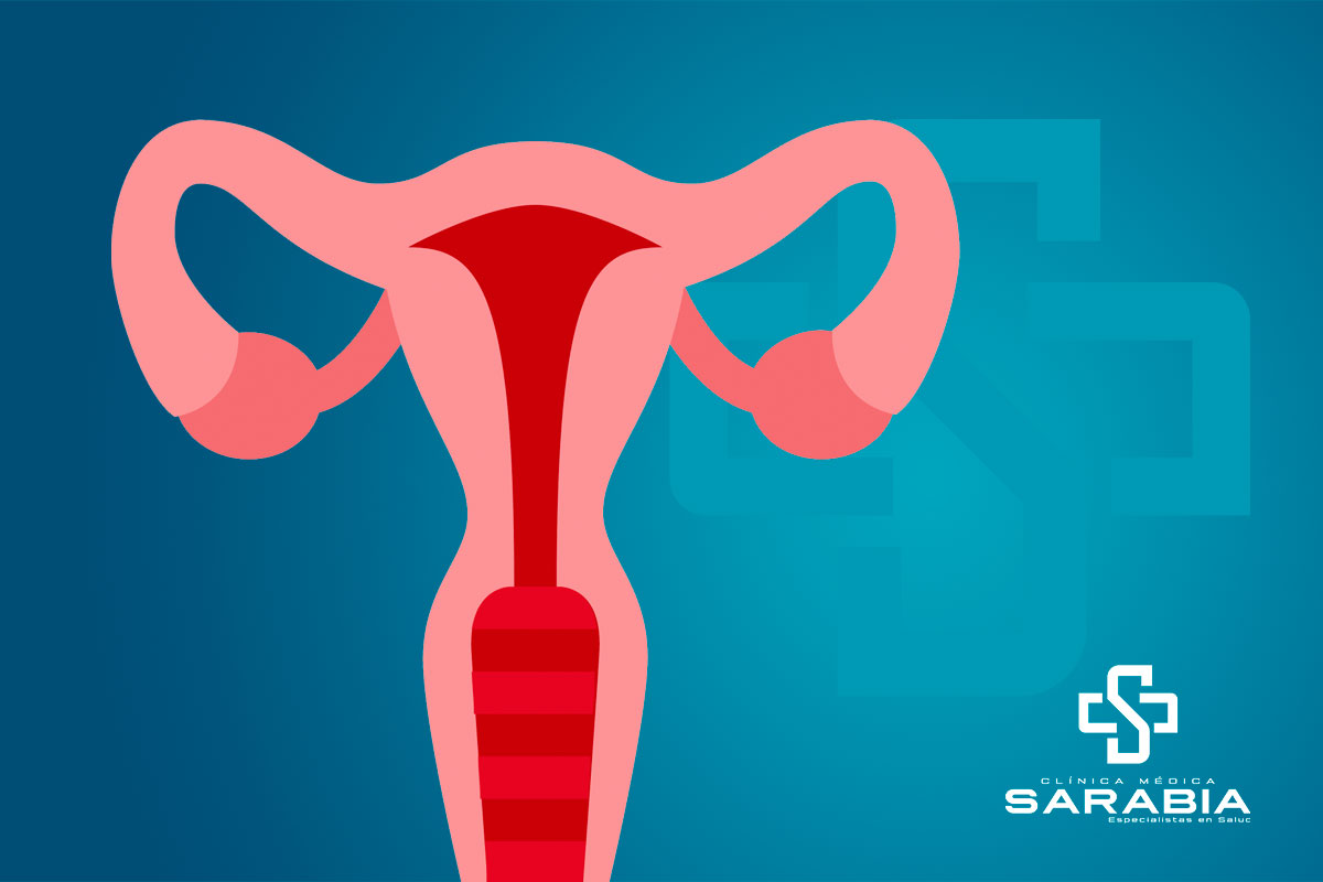 Histerectomia tehuacan clinica especialista