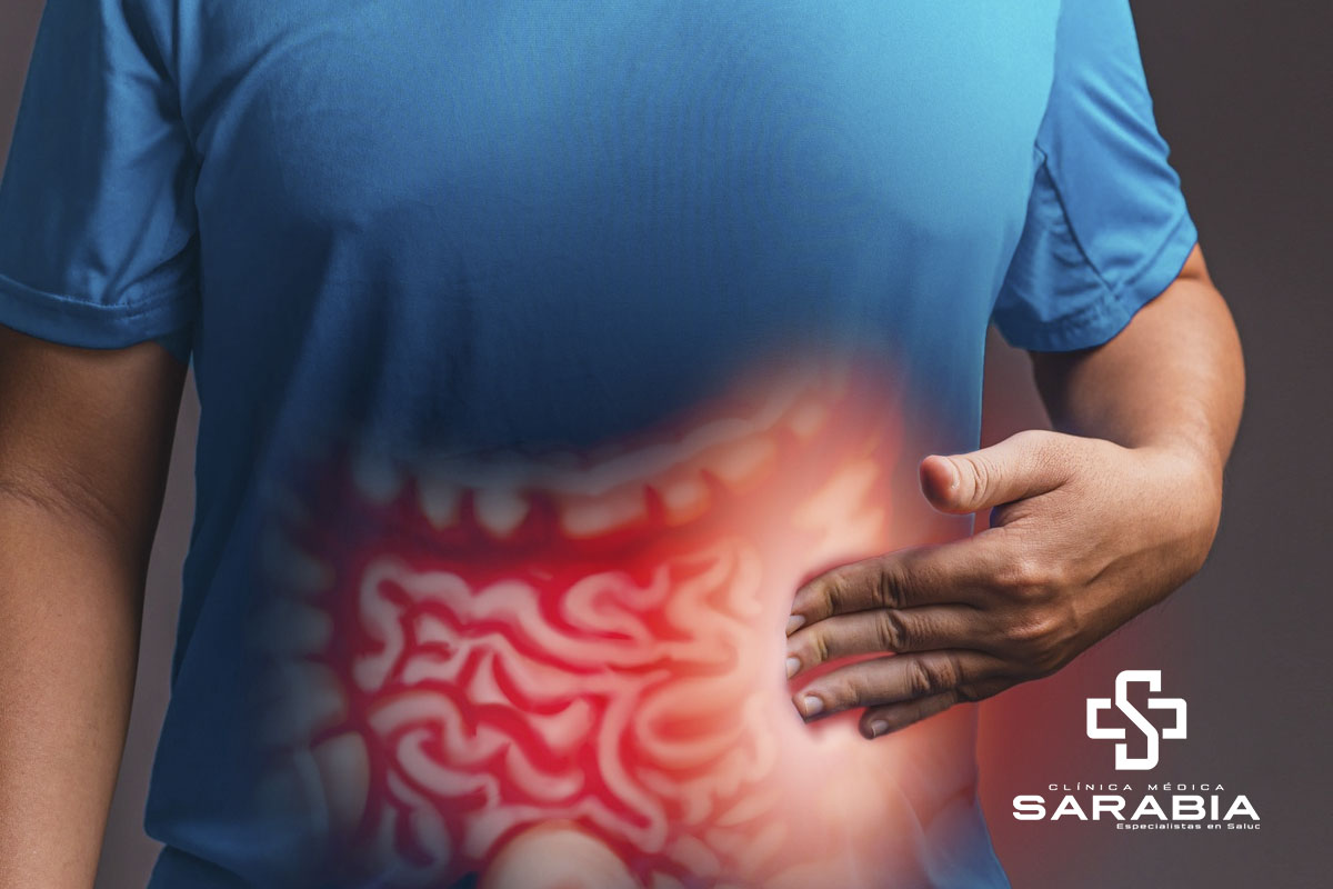 Colitis Ulcerativa en Tehuacan