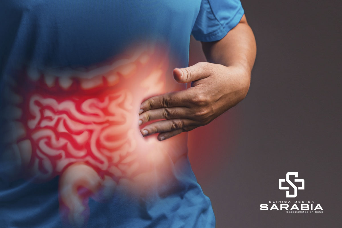 Prevención y Tratamiento del Cáncer de Colon en Tehuacán